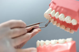 Implantología dental