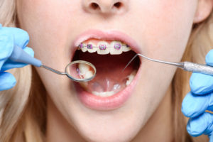 Periodoncia - Omnisalud